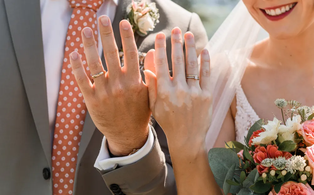 Bride and groom display wedding rings, clasping hands. She holds a bouquet of peach and white flowers. He wears a gray suit with a polka-dotted orange tie. Both are dressed in wedding attire. Sunlight casts soft shadows, suggesting an outdoor ceremony.